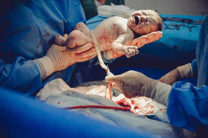 C-section