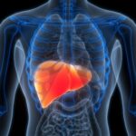 Liver cancer