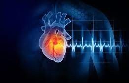 Cardiac arrest